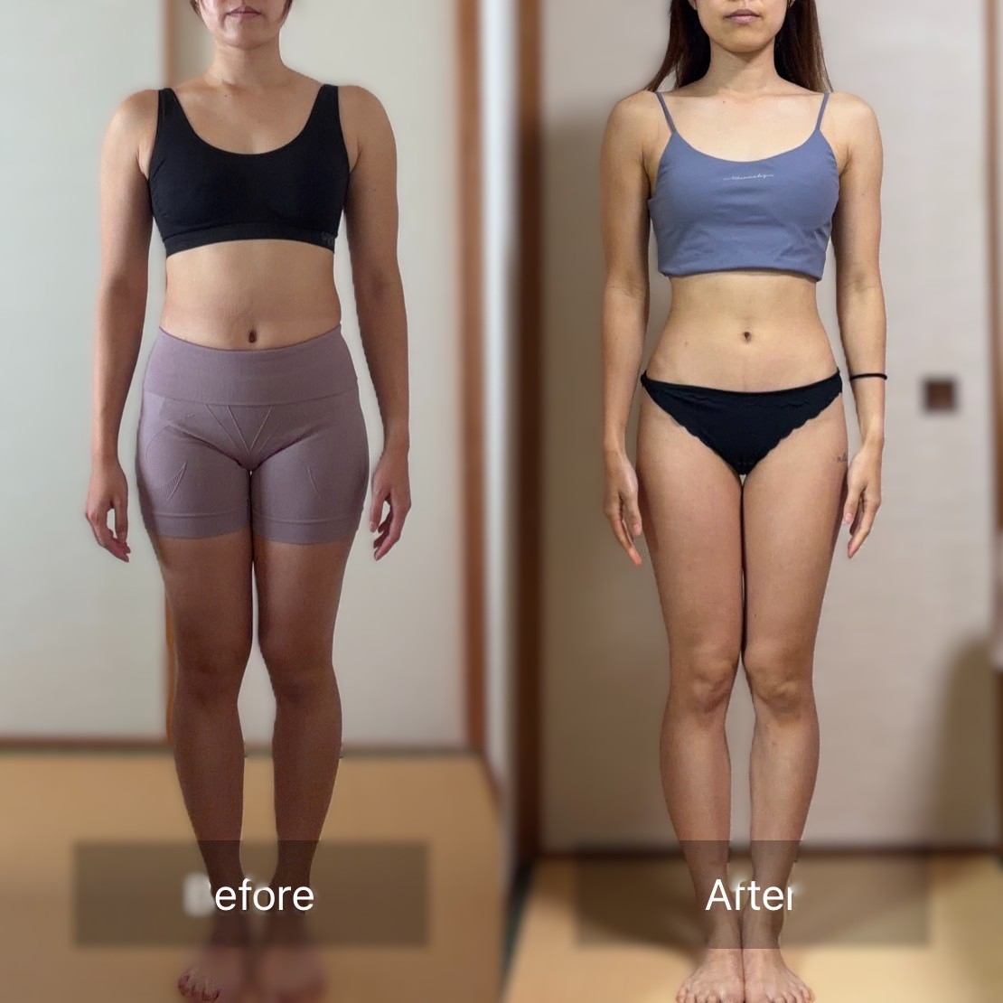 Before After